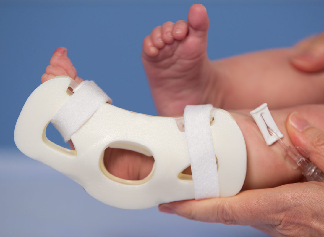949SX TLC Foot Splint on Infant's Foot
