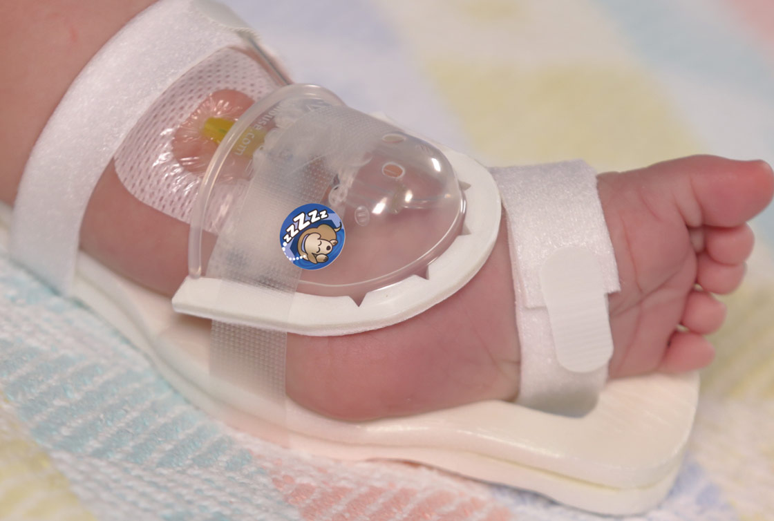 I.V. House 727SFP UltraDome in infant's foot 