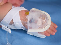 727SFP I.V. House UltraDome on infant's hand